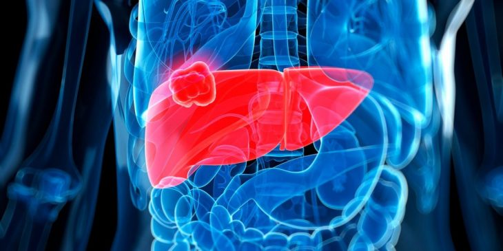 Cannabis and Its Fight against Liver Cancer